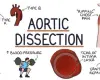 Aortic dissection causes symptoms and risk factors