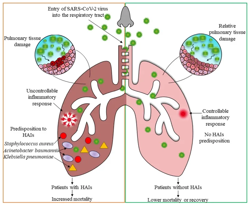 A doctor discusses the dangers of Acinetobacter infection