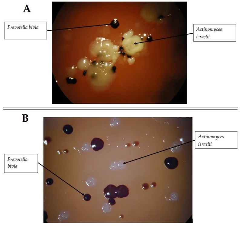 Explaining how Acinetobacter is transmitted in hospitals