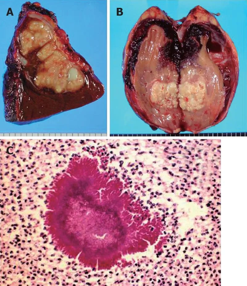 Locations where Acinetobacter baumannii is commonly found