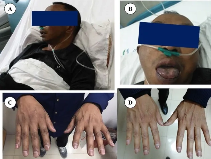 Hydrocortisone medication for adrenal health