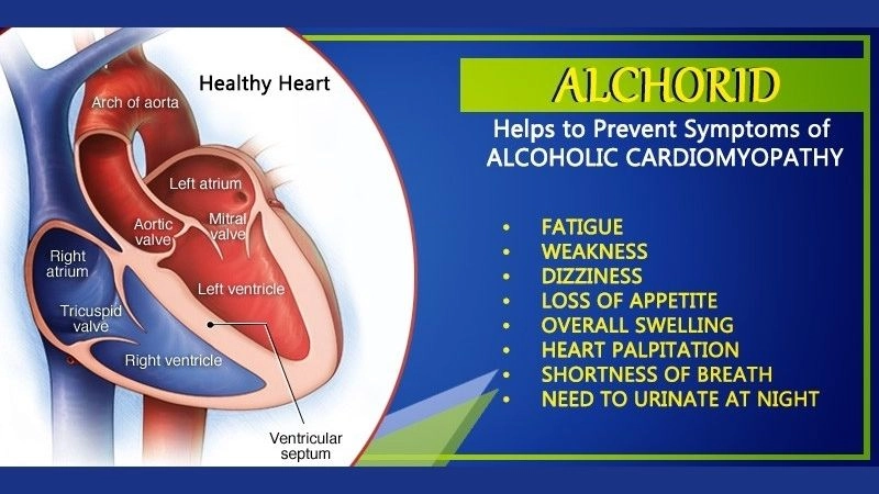 Alcoholic cardiomyopathy prognosis outlook for affected patients