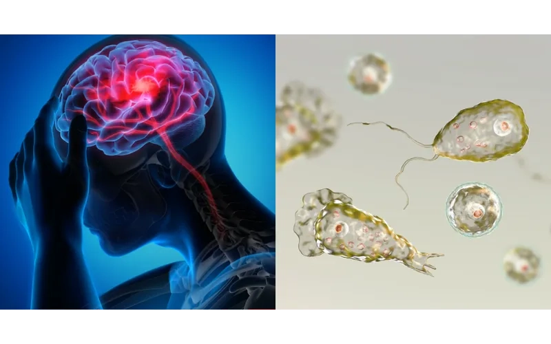 A CT scan showing a large amebic liver abscess