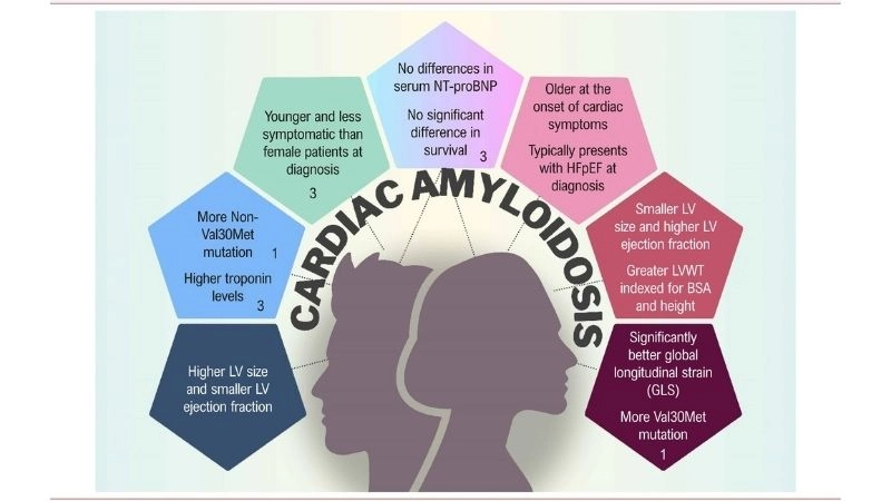 Amyloidosis abnormal protein buildup affecting organs