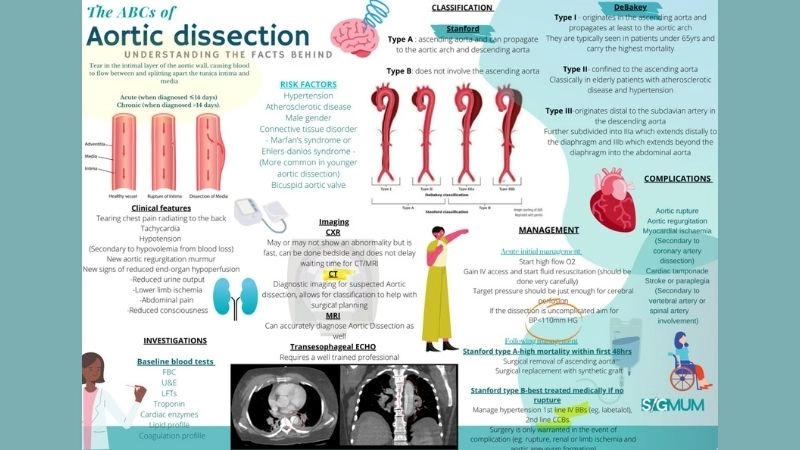 Aortic dissection vs aneurysm major key differences