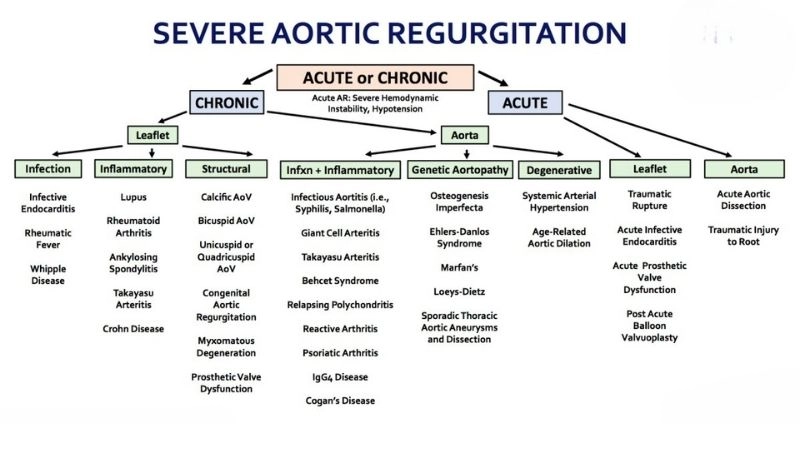Aortic Regurgitation Surgery restores valve function