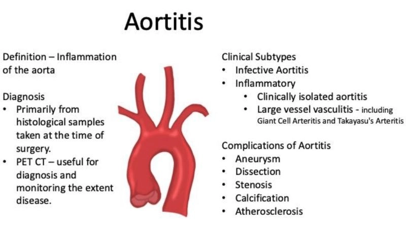 Common aortitis symptoms signaling vascular inflammation