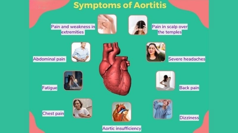 Aortitis treatment options for better health outcomes