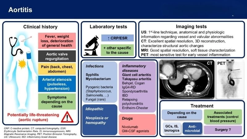 Infectious aortitis and dangerous microbial threats