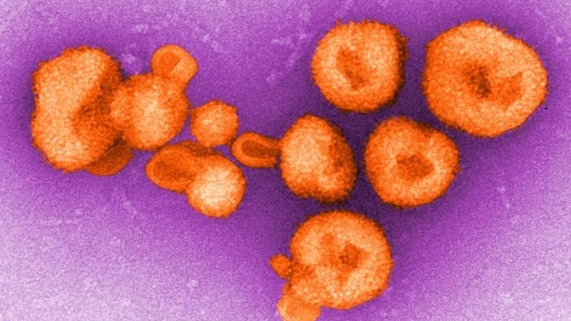 Argentine Hemorrhagic Fever RNA virus strain