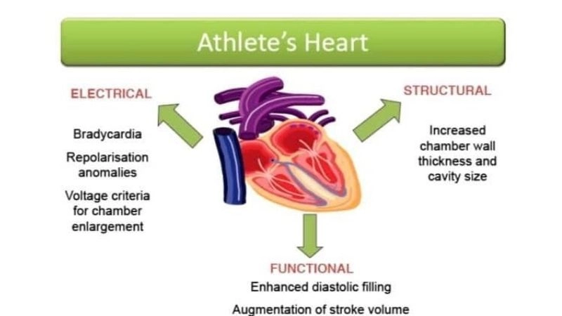 Accurate steps for athlete's heart diagnosis