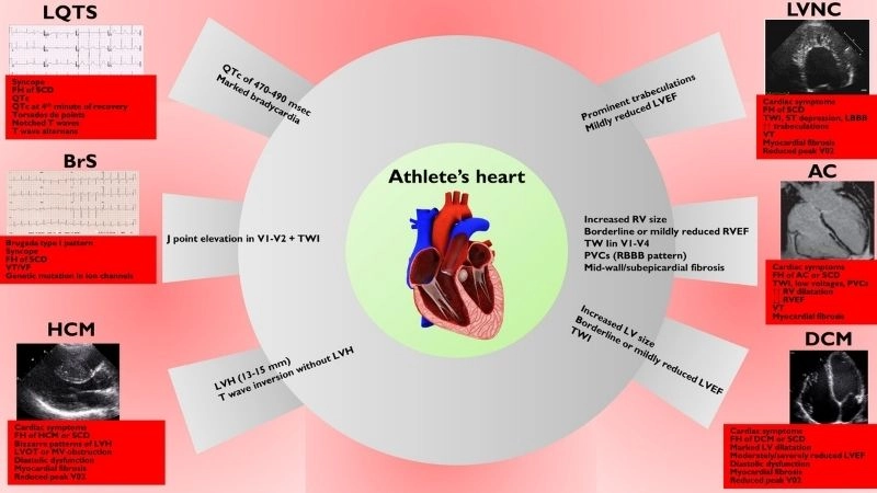 Is athlete's heart dangerous to health