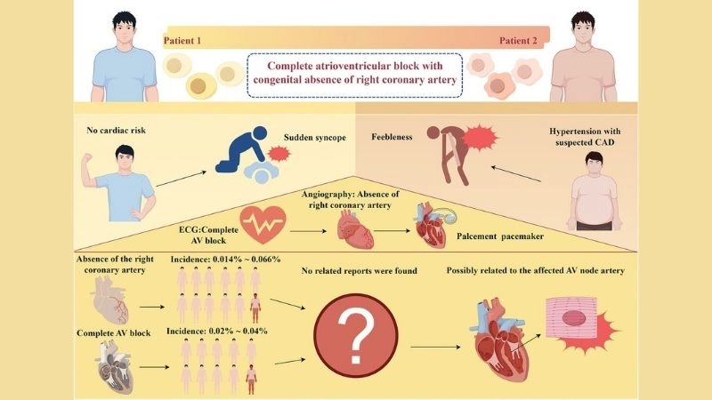 Congenital heart block a challenge from birth
