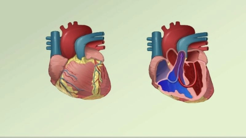 AV canal defect in children common presentation of congenital defect