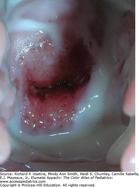 Medical professional discussing effective BV treatment