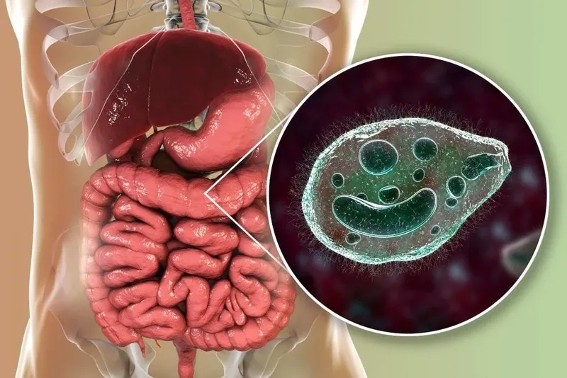 Illustration showing the progression of a parasitic infection