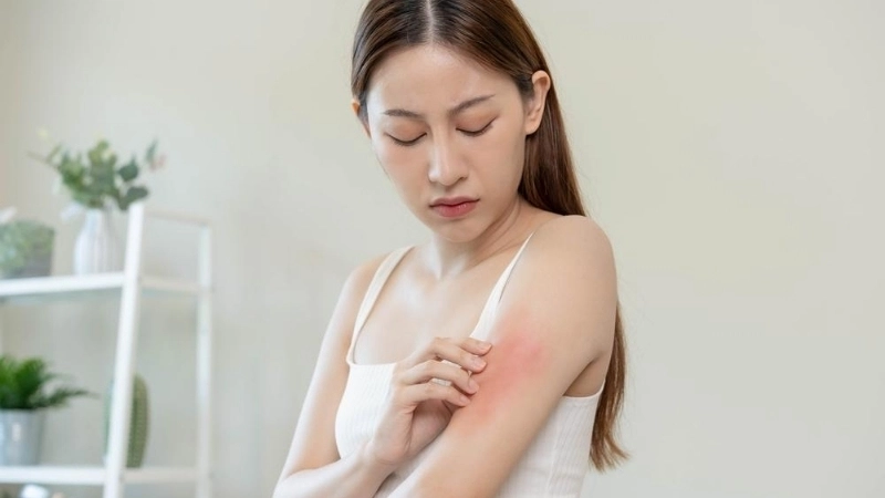 Barmah Forest Virus Disease spread by BFV mosquito bites