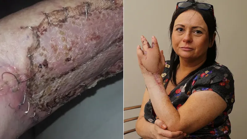 A microscopic view for Bartonellosis microbiology studies