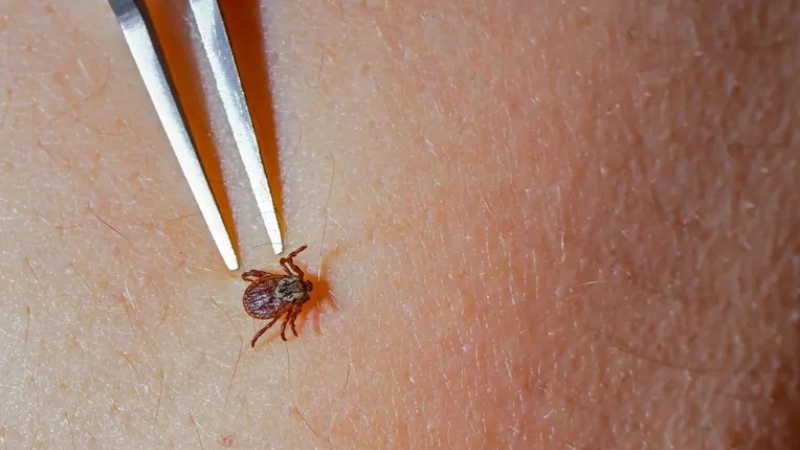 A physician studying a list of tick-borne illness types