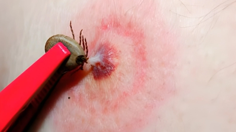 Healthcare provider discussing Bourbon virus treatment options