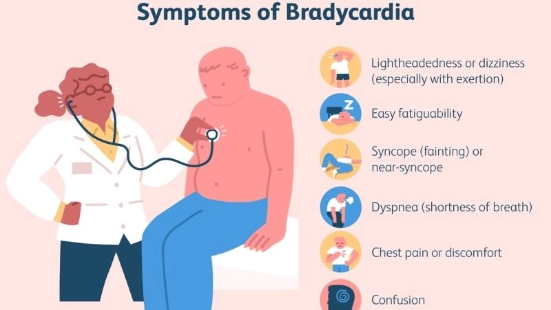 Symptoms of bradycardia include fatigue dizziness and fainting