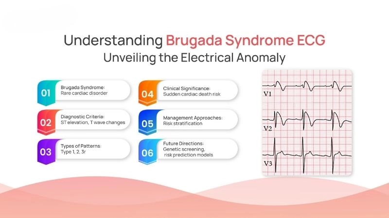 Brugada Syndrome Treatment offers hope for patients