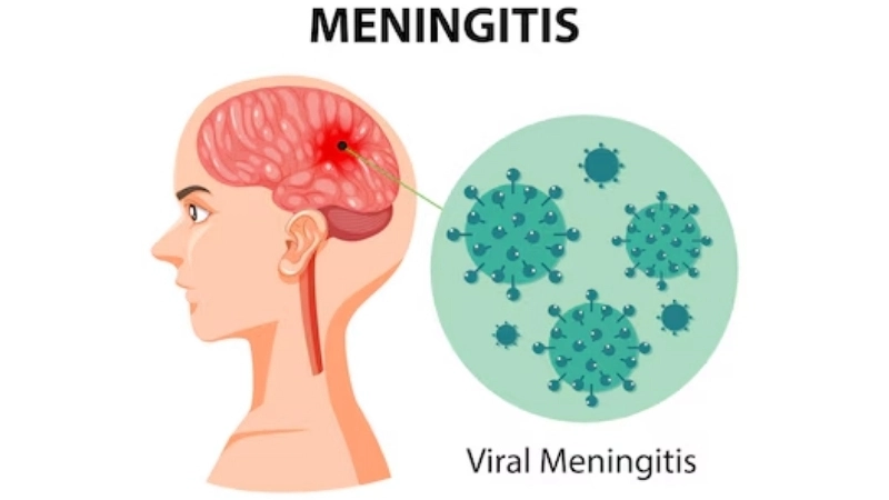 Early encephalitis diagnosis can save lives