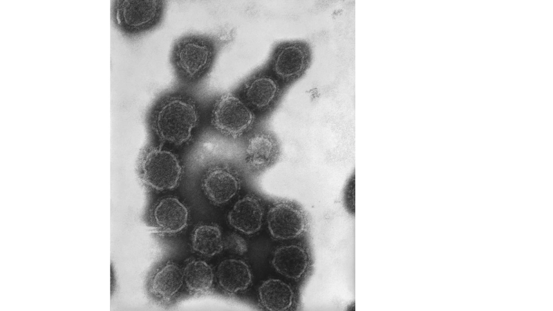 Understand risks of the California serogroup virus