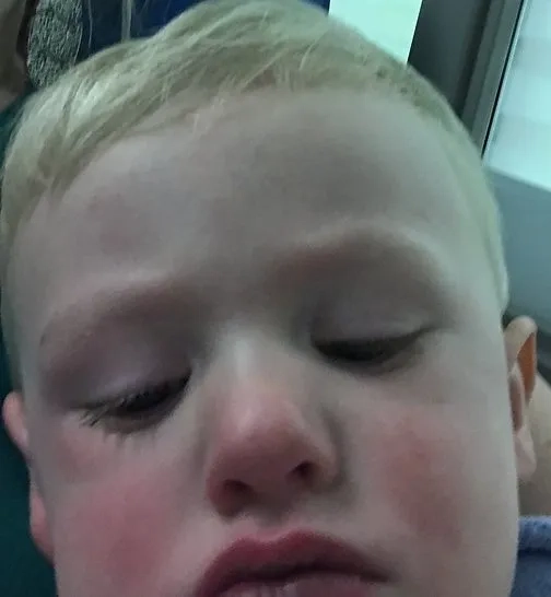 Doctor discussing a patient's Campylobacter infection