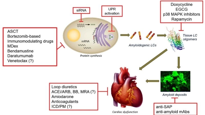 Modern options for cardiac amyloidosis treatment