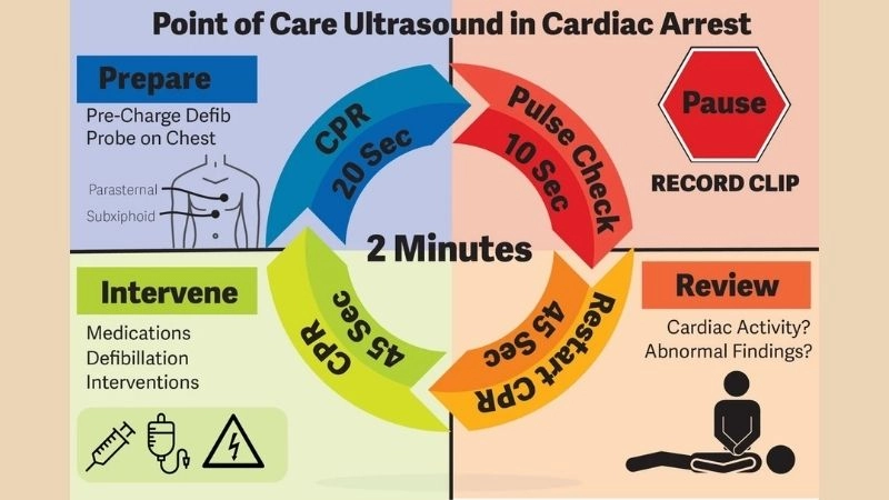 Risks in out of hospital cardiac arrest