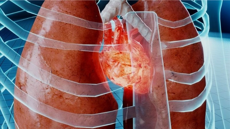 Recognising hidden myocardial contusion symptoms