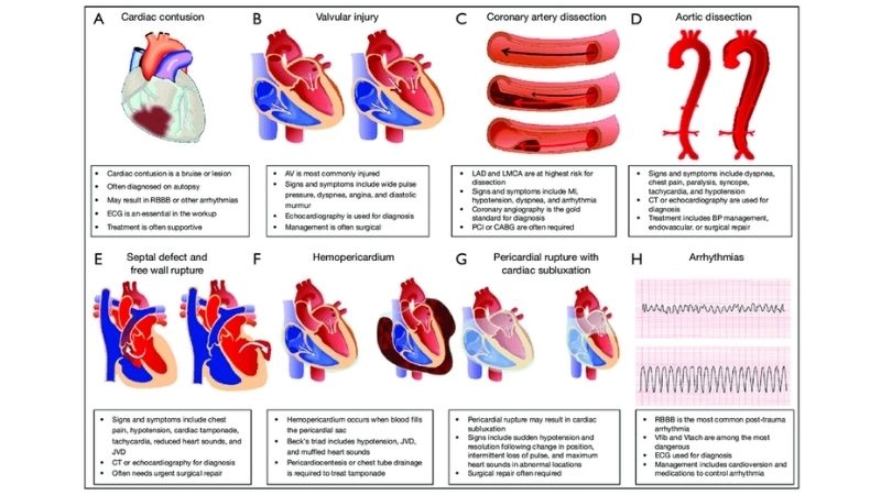 Accuracy in blunt cardiac injury diagnosis
