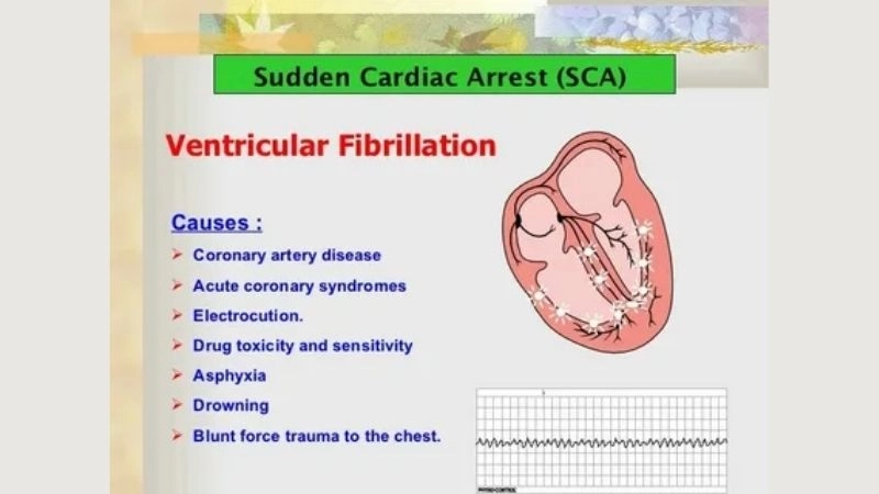 Lifesaving ways of cardiac contusion treatment
