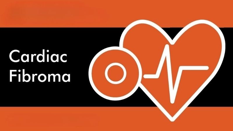 Realistic image of cardiac fibroma symptoms