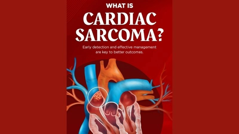 Cardiac sarcoma symptoms warning signs of rare heart cancer