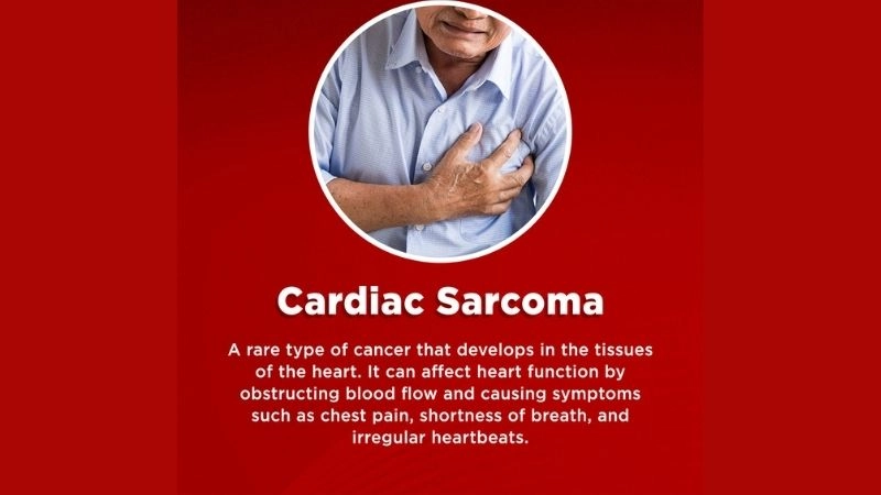 Cardiac sarcoma treatment medical and surgical interventions