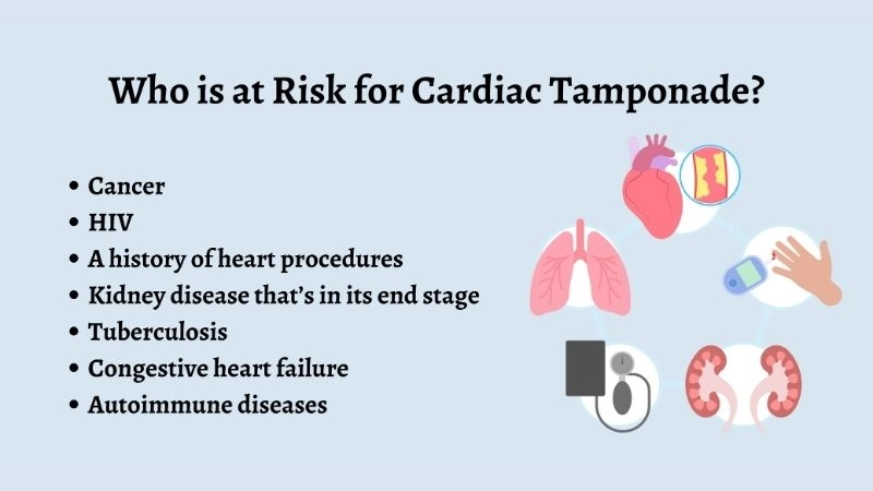 Causes of cardiac tamponade underlying triggers of condition