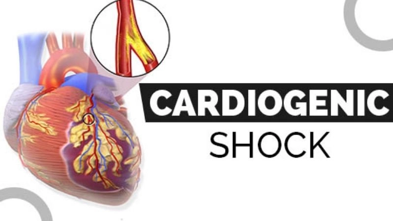 Warning signs of cardiogenic shock symptoms