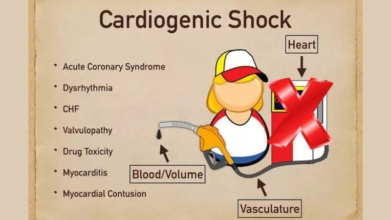 Effective plans for cardiogenic shock management
