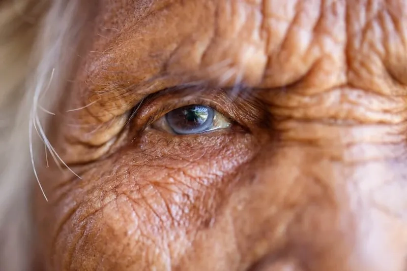 The timeline for cataract surgery recovery
