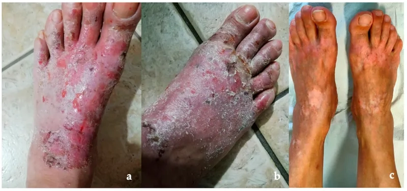 A delicious and safe gluten free meal