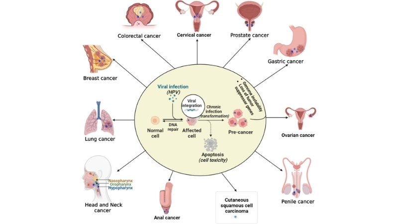 Cervical Cancer symptoms show early health warning