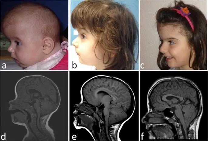 An illustration of pressure-related headaches