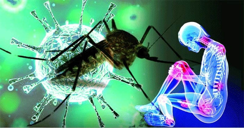 A person experiencing severe joint pain from chikungunya