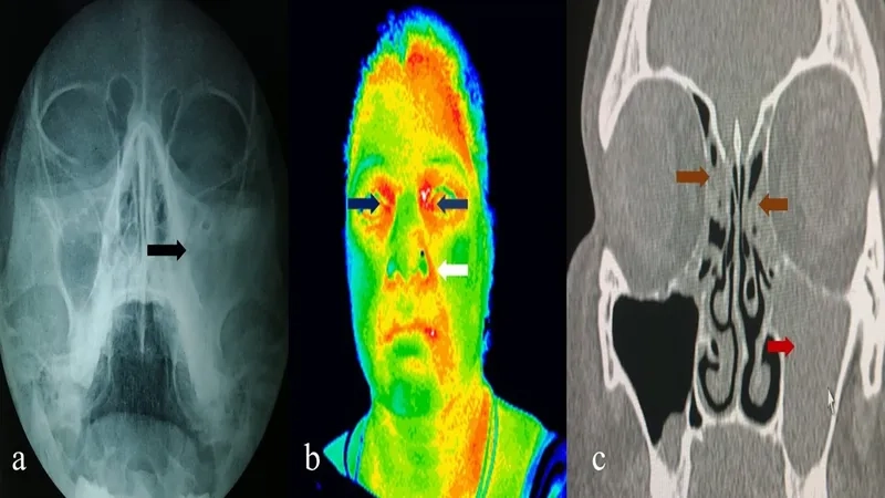 Person researching sinusitis symptoms on a laptop