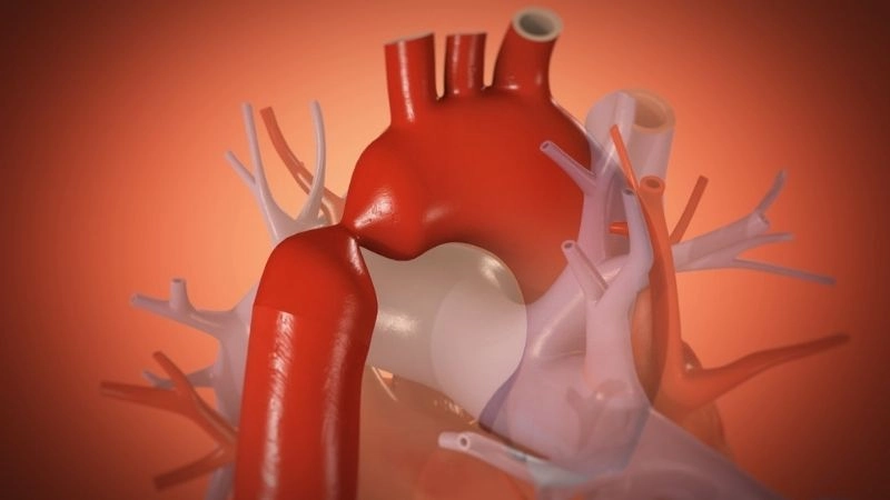 Coarctation of the aorta and pregnancy managing maternal health
