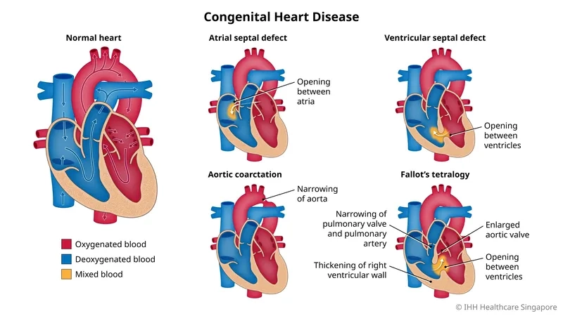 A visual guide to congenital heart disease symptoms