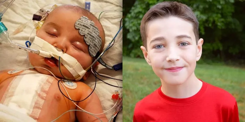 Managing congenital heart disease in adults effectively