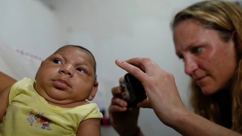 Congenital Zika Syndrome found by Zika diagnosis